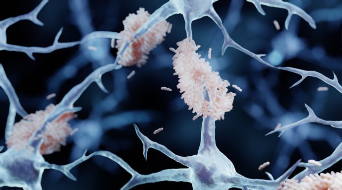 Archivo - Imatge de recurs de l'Alzheimer