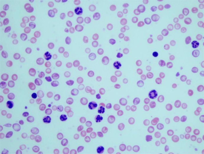 Granulocitos en muestras sanguíneas de ratones con leucemia mielogénica crónica.