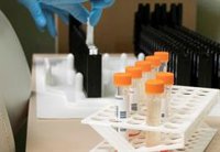 Los casos activos de viruela del mono bajan en Andalucía hasta 12, con 57 en investigación, y los vacunados suman 2.133