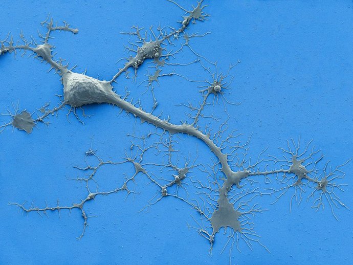 Esta micrografía electrónica de barrido coloreada muestra una neurona humana cultivada con dendritas y axones.