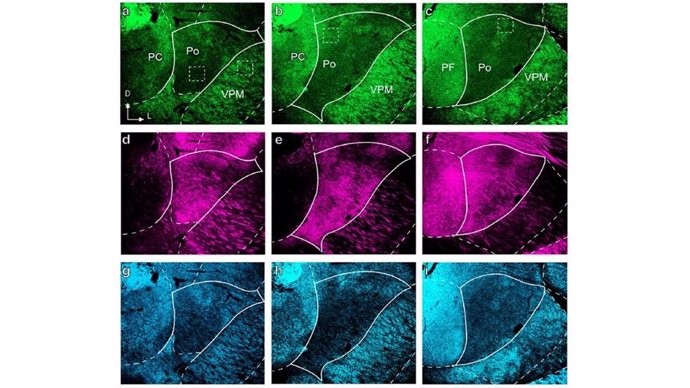 Comparación en microscopia de fluorescencia confocal de la distribución en el núcleo posterior (Po) del tálamo de las terminaciones sinápticas procedentes del tronco del encéfalo y de la médula espinal (en verde) o de la corteza cerebral (en rojo).