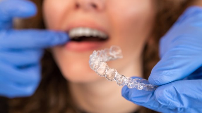 Archivo - Médico ortodoncista colocando brackets transparentes invisibles de silicona en los dientes de la mujer.