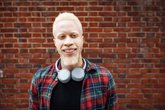 Foto: ¿Por qué hay más albinos en África que en España? Qué es el albinismo y qué implica