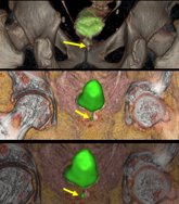 Foto: Experto destaca la utilidad de la inteligencia artificial en la interpretación de los estudios PET-CT