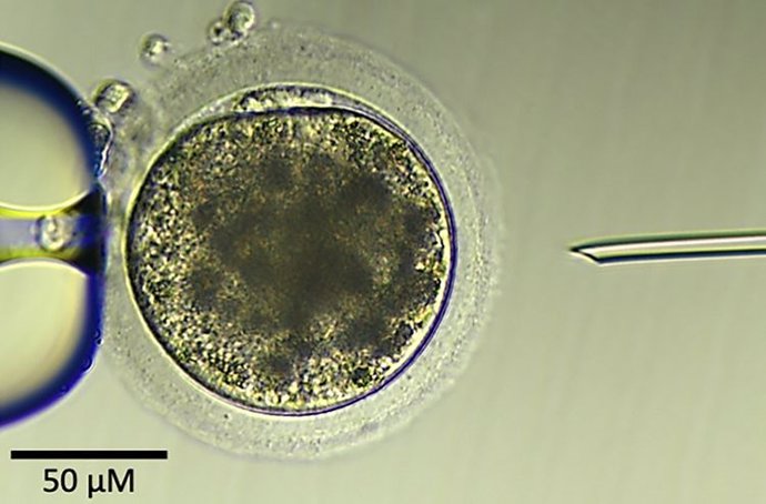 Un óvulo de burra inmediatamente antes de una inyección intracitoplasmática de espermatozoides