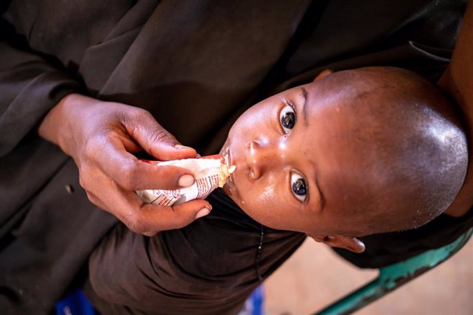 Archivo - Intervención de UNICEF para ayudar a niños desnutridos en Dolow, Somalia