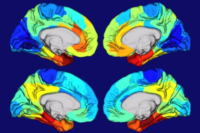 Las áreas rojas y naranjas de estos mapas de calor de cerebros humanos muestran dónde está más activo el gen APOE (dos imágenes cerebrales superiores) y dónde se concentran los ovillos de la proteína tau (dos imágenes cerebrales inferiores).