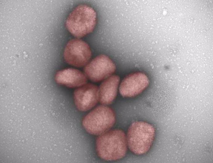 Un Estudio Del Csic Muestra La Presencia Del Virus De La Viruela Del Mono En El Aire Y En La Saliva De Pacientes Infectados