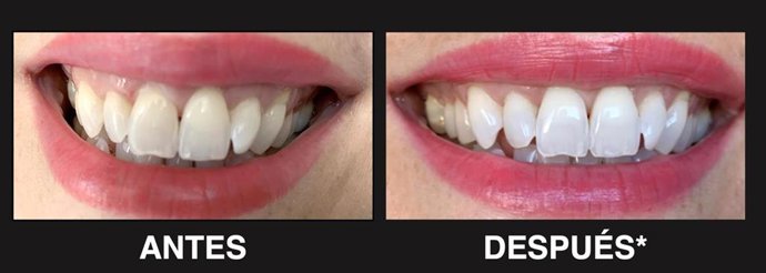 Colgate Max White Ultra Resultado,