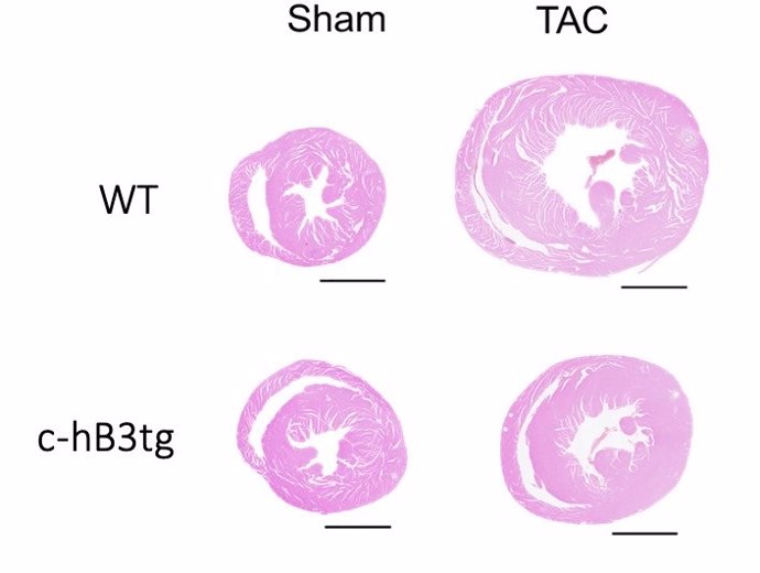 Cortes transversales de corazones de ratones normales (WT) y de transgénicos que sobreexpresan Beta3adrenérgico 3 meses después de una estenosis aórtica (TAC) donde se puede observar una menor hipertrofia en transgénicos.