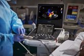Foto: Philips lanza un nuevo sistema de ultrasonidos que permite diagnosticar a más pacientes a la primera