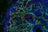 Foto: Un estudio descubre que las células madre del cáncer se alimentan a través del diálogo con su entorno