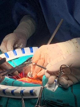 Reparación de vávula aórtica con anillo HAART