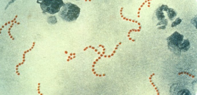Archivo - Bacteria 'streptococcus pyogenes'. Archivo.