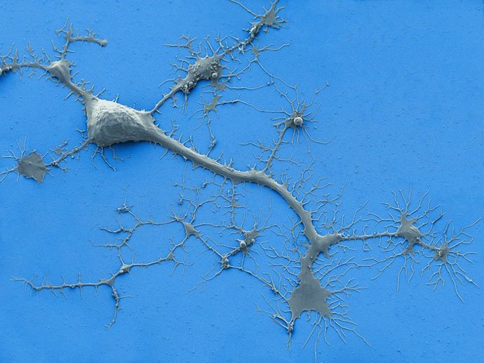 Archivo - Esta micrografía electrónica de barrido coloreada muestra una neurona humana cultivada con dendritas y axones.