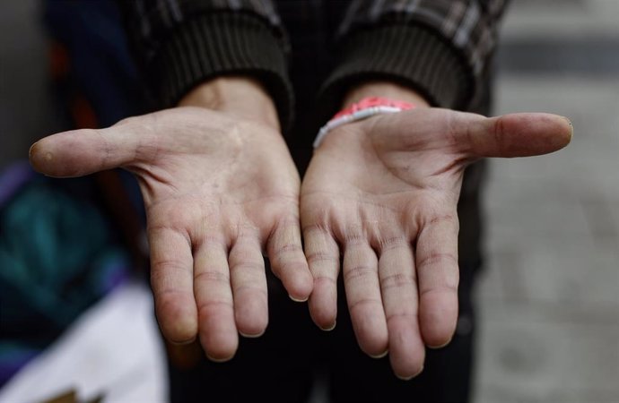 Archivo - Un hombre sin hogar enseña sus manos limpias tras lavárselas