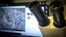 Banco de muestras biológicas de cálculos renales.