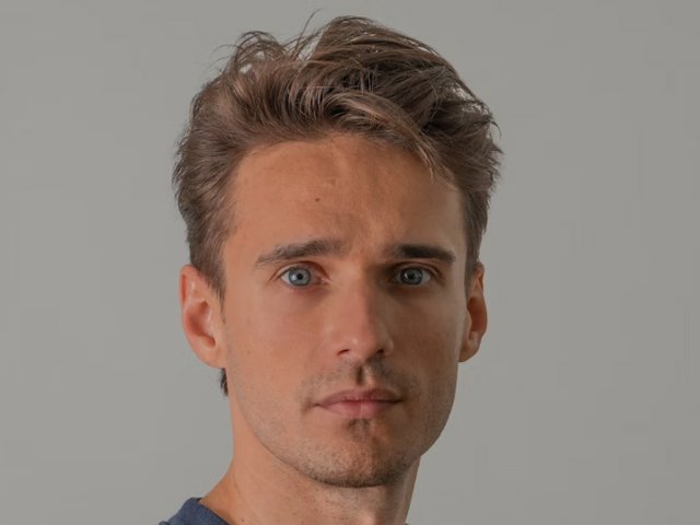 Consejos y recomendaciones a la hora de someterse a un injerto capilar