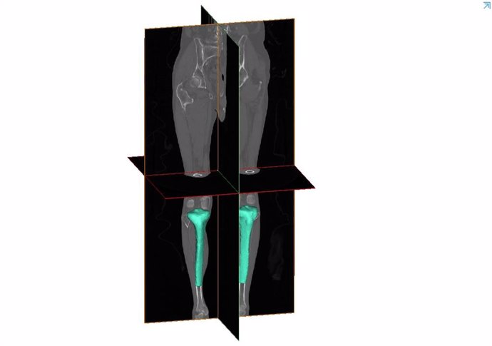 IBV investiga en productos y servicios sanitarios con IA y 3D para enfermedades osteoarticulares
