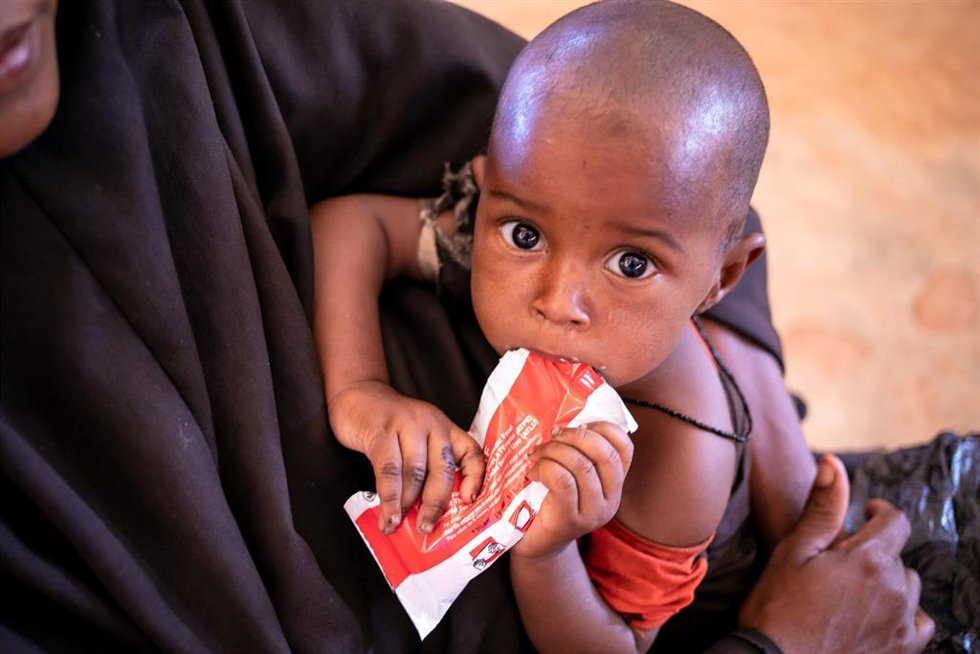Archivo - Los sobres de alimento terapéutico favorecen "la recuperación de más del 80% de niñas y niños" aquejados por la enfermedad.