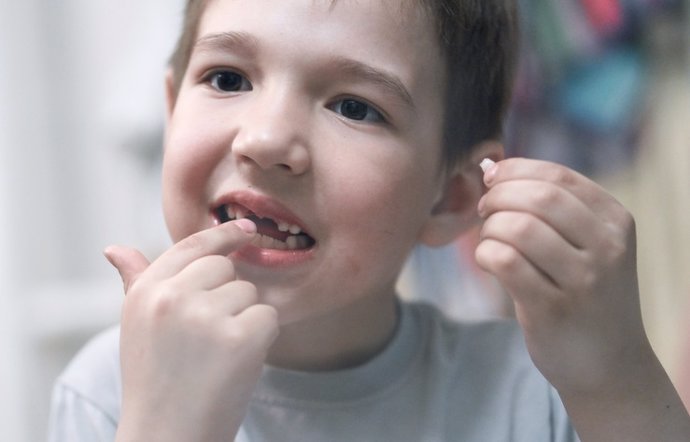 Archivo - Dientes de leche, niño con diente en la mano