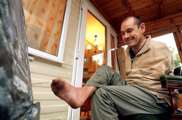 Archivo - Peter Longstaff, víctima de la talidomida, y sin brazos, pinta con el pie derecho. En Kelling (Norfolk, Reino Unido), a 23 de noviembre de 2009.