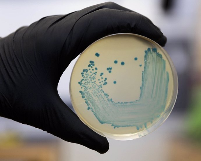 Archivo - Food Safety Pathogen Listeria Monocytogenes Isolated On Agar From A Food Sample.