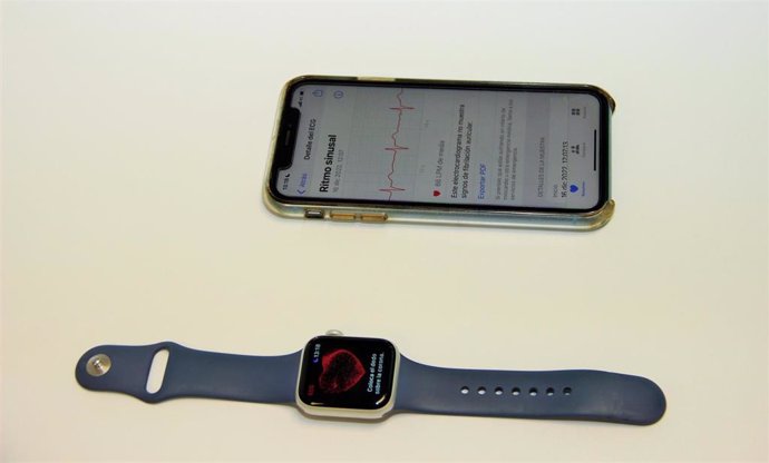 El Clínico San Carlos detecta con un smartwatch una arritmia grave en un paciente