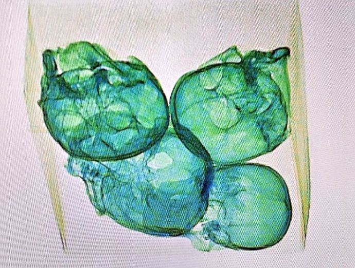 Los cuatro cráneos escaneados por un escáner de rayos X