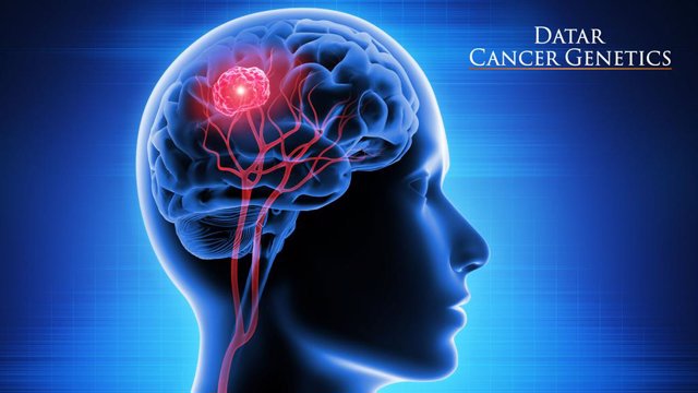 Blood Test to Help Diagnose Inaccessible Brain Tumors