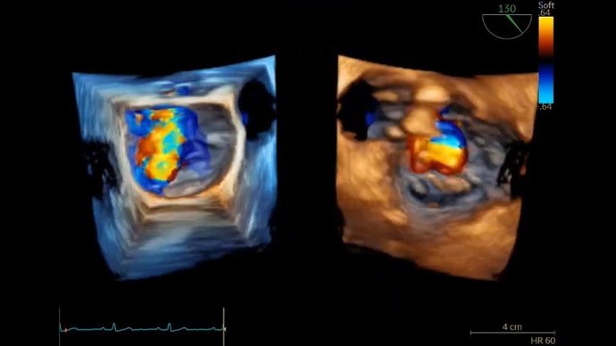 Archivo - GE Healthcare presenta avances en IA para el diagnóstico en cardiología en Congreso SEC.