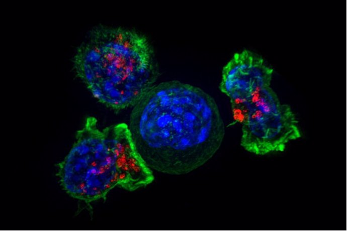 Un Caballo De Troya Contra El Cáncer: Células Diseñadas Genéticamente Y Ocultas En Biocápsulas Para Atacar Tumores Sólidos Desde Dentro