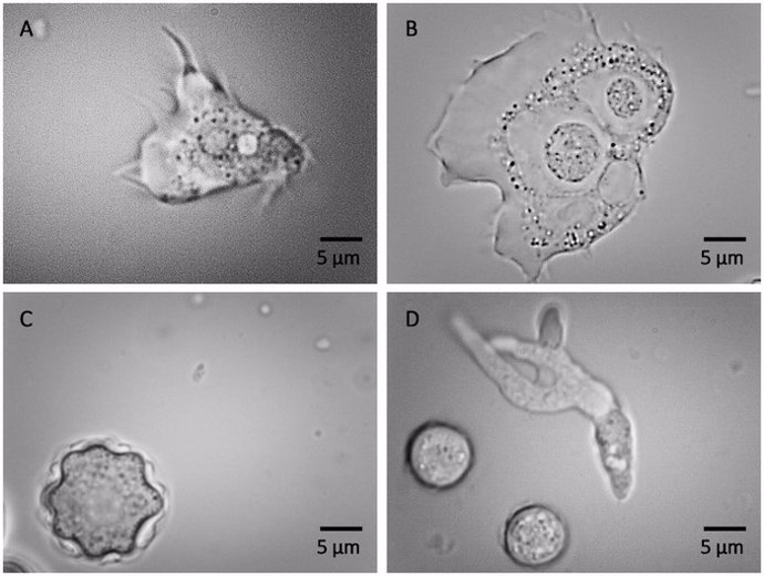 Imágenes microscópicas de luz de trofozoítos (forma activa; imagen A, B y D) y quistes (forma latente; imagen: C y D de forma circular) de Acanthamoeba (imagen A, B y C) y Vermamoeba vermiformis (imagen D) que se muestran en Aumento de 100 veces.