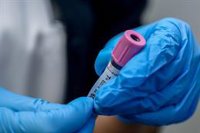 Andalucía registra en Cádiz el primer caso de la variante 'kraken' de la Covid-19 y la Junta pide tranquilidad