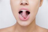 Foto: Experta avisa de que los piercings orales pueden provocar lesiones en las encías y en los tejidos duros y blandos