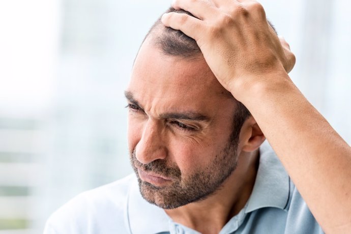 Archivo - Hombre maduro concentrado, alopecia, preocupado, pelo.