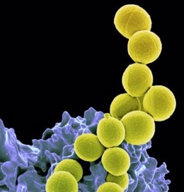 Bacteria Staphylococcus aureus resistente a la meticilina (amarilla) siendo ingerida por neutrófilos (azul púrpura).