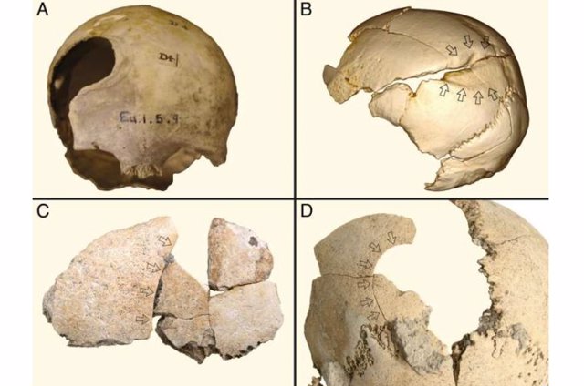 Ejemplos de traumatismo por objeto contundente en cráneos neolíticos del noroeste de Europa: (A) Belas Knap, Inglaterra (sin curar); (B) Schöneck-Kilianstädten, Alemania (curado); (C y D) Halberstadt, Alemania (sin curar).