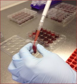 Muestra de sangre en la Estación Experimental del Zaidín