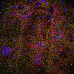 Imagen microscópica de células neurales con nanopartículas de óxido de hierro: neuronas (rojo), sinapsis (verde) y núcleos celulares (azul).