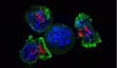 Foto: Las células cancerosas se encogen o aumentan de tamaño para resistir al tratamiento y sobrevivir