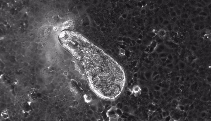 Imagen de microscopio del gusano parásito Fasciola hepatica.