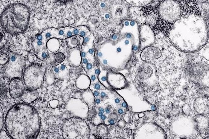 Partículas del virus SARS-CoV-2, coloreadas en azul, en una imagen de microscopio de electrones. /