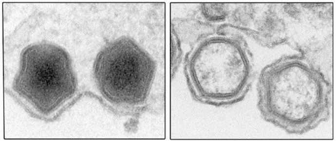 Micrografías electrónicas de partículas del virus de la peste porcina africana producidas en presencia (izqda.) y ausencia (dcha.) de la proteína pEP84R /