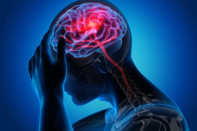 Archivo - Epilepsia