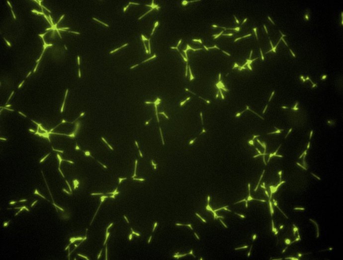 Células fluorescentes de Mycoplasma pneumoniae