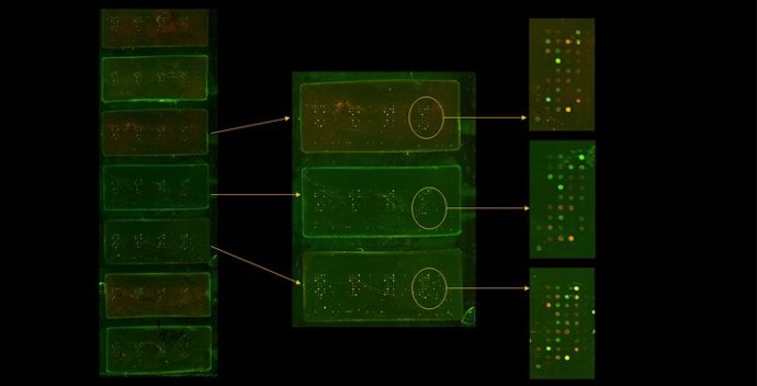 Estudio del chip para diagnosticar patologías articulares de manera precoz.