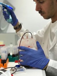 Investigadores de Ibima desarrollan metodología para el diagnóstico precoz de cáncer de mama con una muestra de sangre