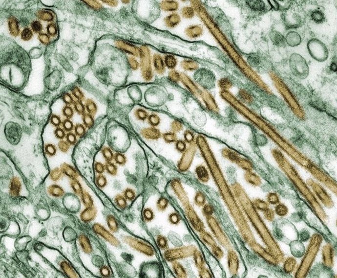 Archivo - Virus de la gripe H5N1
