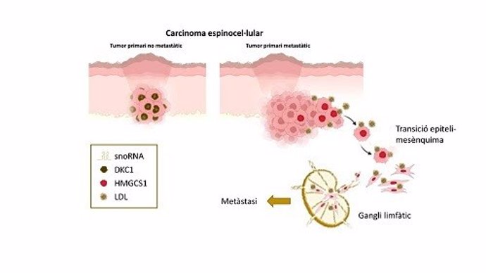 Diagrama sobre el proceso observado en el estudio y por el cual las células de estos tumores cambian su metabolismo antes de hacer la metástastasis y extenderse